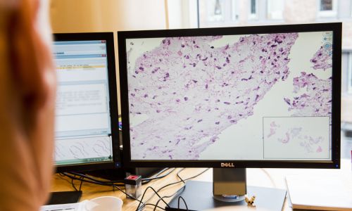 Ny teknologi skal gjøre det enklere å samarbeide om analyse av kreftprøver